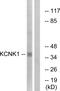 Potassium Two Pore Domain Channel Subfamily K Member 1 antibody, GTX87344, GeneTex, Western Blot image 