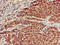 Secretin Receptor antibody, LS-C679410, Lifespan Biosciences, Immunohistochemistry paraffin image 