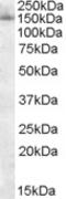 Splicing Factor 3b Subunit 3 antibody, LS-C55433, Lifespan Biosciences, Western Blot image 