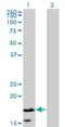 Calmodulin Like 5 antibody, H00051806-M16, Novus Biologicals, Western Blot image 