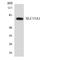 Solute Carrier Family 15 Member 1 antibody, LS-C200674, Lifespan Biosciences, Western Blot image 