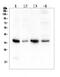 Annexin A3 antibody, A04796, Boster Biological Technology, Western Blot image 