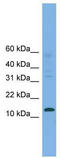 Cellular Retinoic Acid Binding Protein 2 antibody, TA346306, Origene, Western Blot image 