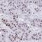 Centrosomal Protein 72 antibody, NBP2-34103, Novus Biologicals, Immunohistochemistry paraffin image 