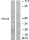 Tripartite Motif Containing 59 antibody, TA316332, Origene, Western Blot image 