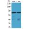 Solute Carrier Family 22 Member 6 antibody, LS-C387142, Lifespan Biosciences, Western Blot image 