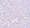 Calcium Homeostasis Modulator 1 antibody, PA5-20895, Invitrogen Antibodies, Immunohistochemistry paraffin image 
