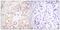 B-Raf Proto-Oncogene, Serine/Threonine Kinase antibody, A30441, Boster Biological Technology, Immunohistochemistry paraffin image 