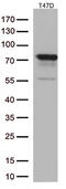 Na(+)/H(+) exchange regulatory cofactor NHE-RF3 antibody, M03176, Boster Biological Technology, Western Blot image 