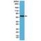Neurofilament Light antibody, M02482-5, Boster Biological Technology, Western Blot image 