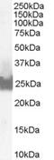 Oxysterol-binding protein 1 antibody, 46-113, ProSci, Western Blot image 