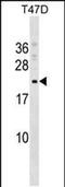 COMM domain-containing protein 9 antibody, PA5-48869, Invitrogen Antibodies, Western Blot image 