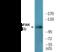 Protein Tyrosine Kinase 2 antibody, EKC2549, Boster Biological Technology, Western Blot image 