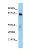 ETS Variant 1 antibody, orb329615, Biorbyt, Western Blot image 