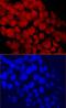 Chromodomain Helicase DNA Binding Protein 1 antibody, MAB6195, R&D Systems, Immunofluorescence image 