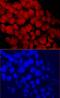 Chromodomain Helicase DNA Binding Protein 1 antibody, MAB6195, R&D Systems, Immunofluorescence image 