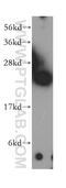 NADH:Ubiquinone Oxidoreductase Core Subunit V2 antibody, 15301-1-AP, Proteintech Group, Western Blot image 