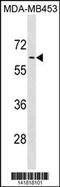 Adrenoceptor Alpha 1B antibody, 60-786, ProSci, Western Blot image 