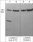 Actinin Alpha 4 antibody, AP4271, ECM Biosciences, Western Blot image 