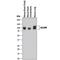 Activated Leukocyte Cell Adhesion Molecule antibody, PA5-47083, Invitrogen Antibodies, Western Blot image 