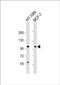 Rhomboid 5 Homolog 2 antibody, PA5-48602, Invitrogen Antibodies, Western Blot image 