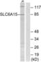 Solute Carrier Family 6 Member 15 antibody, LS-C120188, Lifespan Biosciences, Western Blot image 