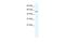 Zinc Finger Protein 286A antibody, A15027, Boster Biological Technology, Western Blot image 