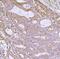 Interferon Regulatory Factor 3 antibody, A00165-6, Boster Biological Technology, Immunohistochemistry paraffin image 