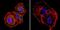 Mesothelioma antibody, MA2-310, Invitrogen Antibodies, Immunofluorescence image 