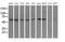 Adenylosuccinate Lyase antibody, MA5-25263, Invitrogen Antibodies, Western Blot image 