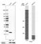 Profilin 2 antibody, NBP1-87426, Novus Biologicals, Western Blot image 
