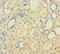Pappalysin 1 antibody, A53093-100, Epigentek, Immunohistochemistry paraffin image 