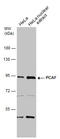 Lysine Acetyltransferase 2B antibody, GTX109666, GeneTex, Western Blot image 