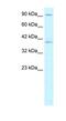 Kinesin Family Member C2 antibody, NBP1-58247, Novus Biologicals, Western Blot image 