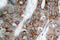 Integrin Subunit Beta 3 antibody, LS-C176080, Lifespan Biosciences, Immunohistochemistry paraffin image 