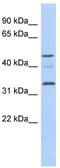 Cyclin Y Like 1 antibody, TA338869, Origene, Western Blot image 