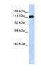 Gse1 Coiled-Coil Protein antibody, NBP1-79573, Novus Biologicals, Western Blot image 