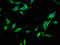 Synaptojanin 1 antibody, CSB-PA023016LA01HU, Cusabio, Immunofluorescence image 