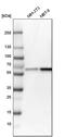 N-Myristoyltransferase 1 antibody, PA5-54648, Invitrogen Antibodies, Western Blot image 