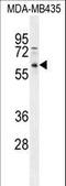 Protein Phosphatase 3 Catalytic Subunit Gamma antibody, LS-C162091, Lifespan Biosciences, Western Blot image 