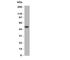 Angiopoietin Like 3 antibody, R31186, NSJ Bioreagents, Western Blot image 