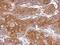 THO Complex 5 antibody, NBP2-20621, Novus Biologicals, Immunohistochemistry paraffin image 