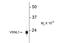 Visinin Like 1 antibody, MA5-18116, Invitrogen Antibodies, Western Blot image 