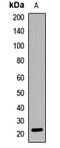 Adenylate kinase isoenzyme 1 antibody, LS-C667686, Lifespan Biosciences, Western Blot image 