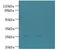 Triggering Receptor Expressed On Myeloid Cells 2 antibody, LS-C376922, Lifespan Biosciences, Western Blot image 