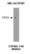 Cytochrome P450 Family 1 Subfamily B Member 1 antibody, NBP2-50190, Novus Biologicals, Western Blot image 