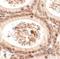 Spermatogenesis Associated 3 antibody, LS-C144442, Lifespan Biosciences, Immunohistochemistry paraffin image 