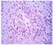 Natural Cytotoxicity Triggering Receptor 1 antibody, GTX52945, GeneTex, Immunohistochemistry frozen image 