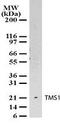 PYD And CARD Domain Containing antibody, PA1-41405, Invitrogen Antibodies, Western Blot image 