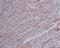 Beta-Actin antibody, M01263-4, Boster Biological Technology, Immunohistochemistry paraffin image 